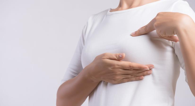10 tévhit a mellrákkal kapcsolatban – ne dőljön be nekik!