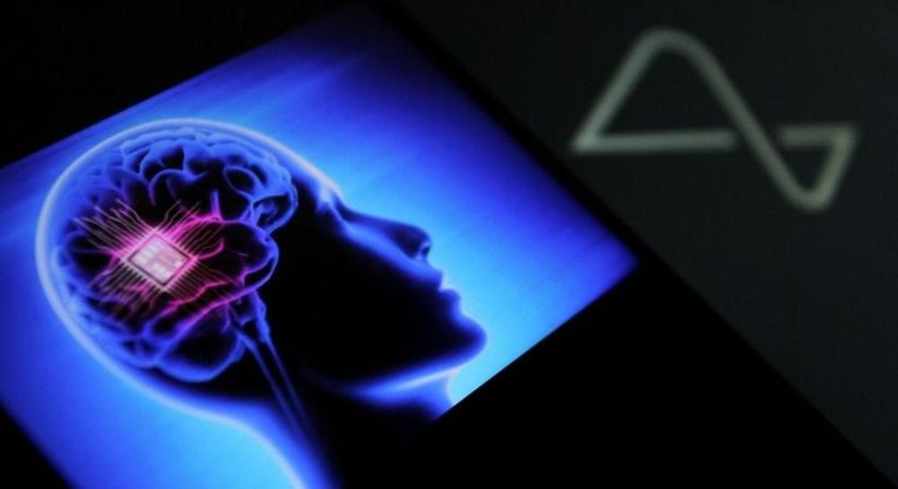 Számítógépes agyi implantátumok kapcsolnák össze az emberi -és a mesterséges intelligenciát