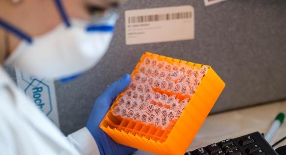 Pécsi virológusok összeszedték, mit érdemes tudni a Covid-vakcinákról