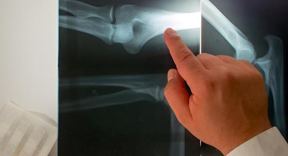 Röntgenszeműek lesznek az okostelefonok: csomagokba lehet majd belátni velük