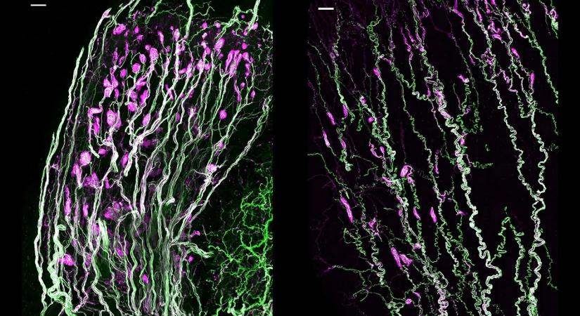 Sikerült végre feltárni a klitorisz és a pénisz érzékenységének neurobiológiai hátterét