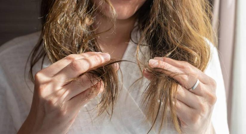 Durván károsítod a hajad, ha erre nem figyelsz: 10 fontos tipp a töredezés ellen