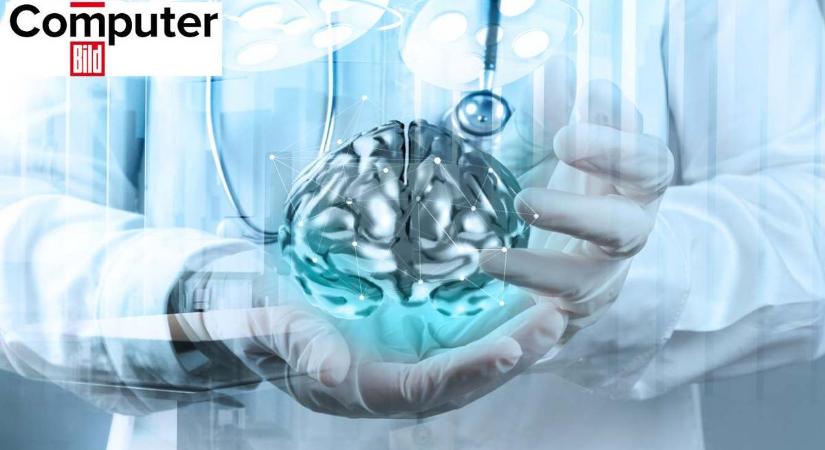Nagy áttörés: a mesterséges intelligencia segíthet jóval hamarabb felismerni az Alzheimer-kór jeleit