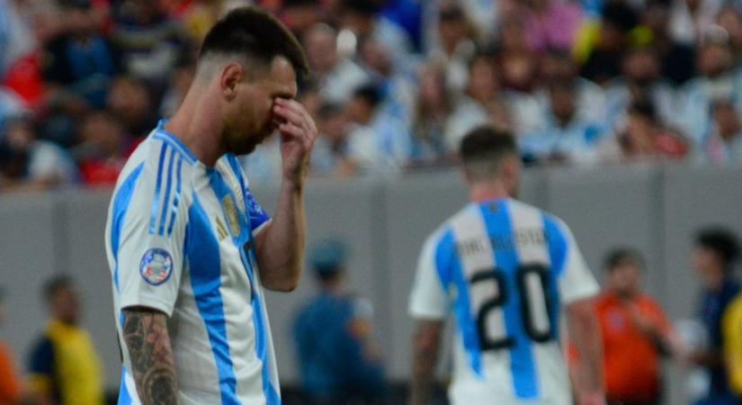 Nagy a baj, Lionel Messi arca mindent elárul arról, min megy keresztül - Fotó