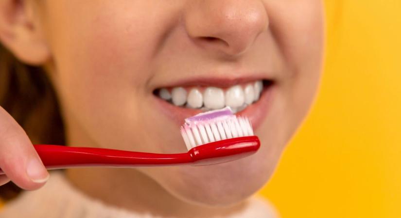 A fogorvos figyelmeztet: 3 hiba, ami miatt sárgák lehetnek a fogaid