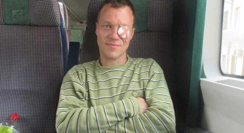 Tibor szemét ki kellett műteni egy daganat miatt