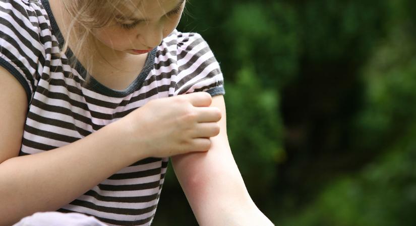 Jöhet a védőoltás a szúnyogok terjesztette betegség ellen