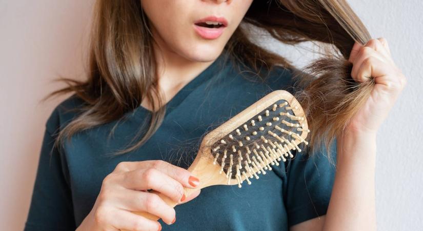 7 gyakori egészségügyi zavar, ami hajhullást okozhat: így tehetsz ellene