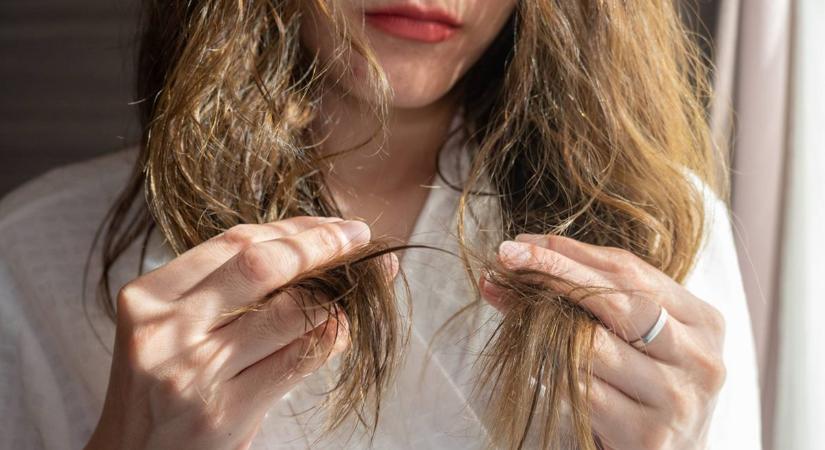 Durván károsítod a hajad, ha erre nem figyelsz: 10 fontos tipp a töredezés ellen