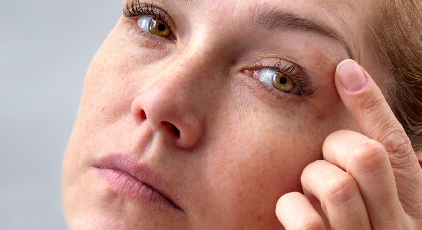 Fáradtság és stressz: ezt teszi a szemhéj izmaival - ebben az esetben forduljon szakorvoshoz