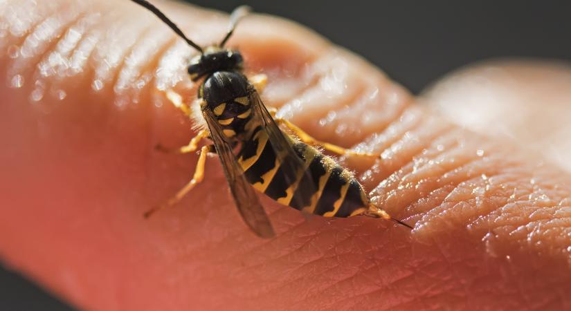 Darázscsípés, méhcsípés után ezek a krémek segíthetnek enyhíteni a tüneteket