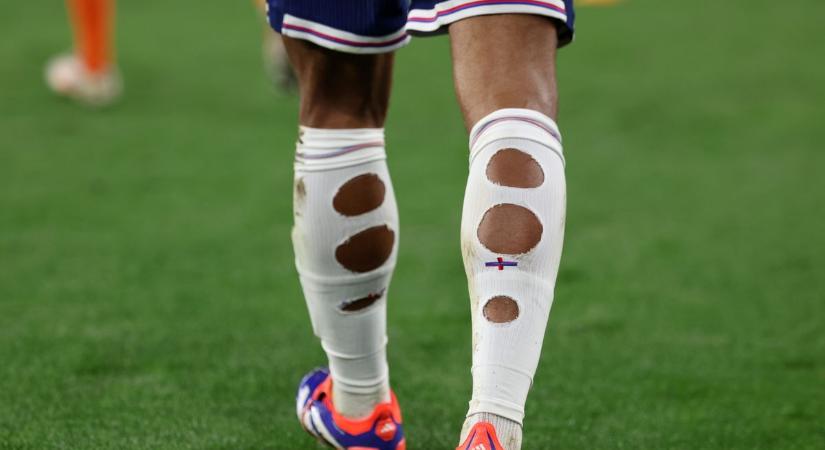 Végre iderült: Miért vágtak lyukakat zoknijukba a focisták az Európa-bajnokságon?