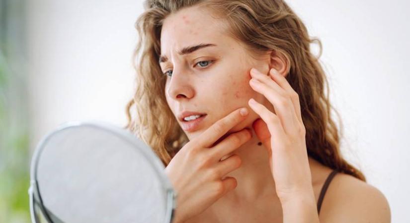 Nem bőrbetegség, mégis az arcon jelentkezik - Ritka neurológiai rendellenessége miatt sokan bántják a nőt