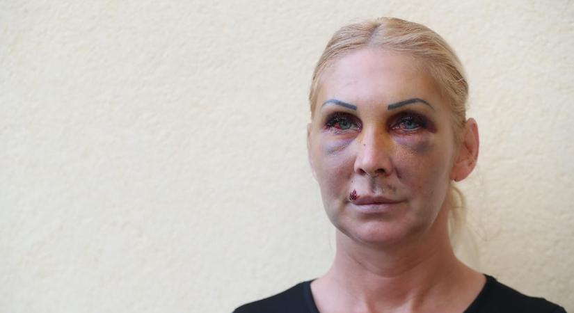 Súlyosabb büntetést kér az ügyészség Orosz Bernadett bántalmazójára – videó