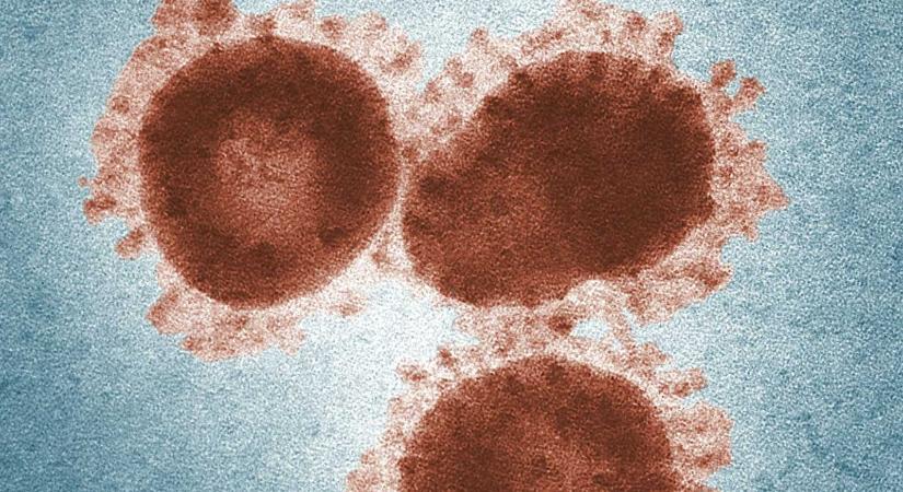 Meghalt egy 14 éves fiú Nipah-vírus okozta fertőzésben