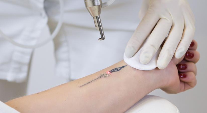 Tetováltatás véralvadásgátló mellett - az orvos elárulja, biztonságos-e