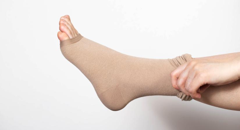 Visszeres lábak - van, hogy egyedül a kompressziós harisnya nem véd a trombózis ellen