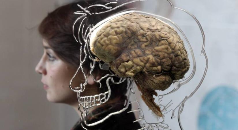 Ennyivel nagyobb az agyunk, mint 1930-ban volt - Döbbenetes, mire jutottak a kutatók