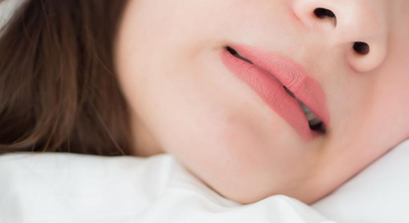 Csikorgatja a fogát alvás közben? Ne legyintsen rá, migrént is okozhat