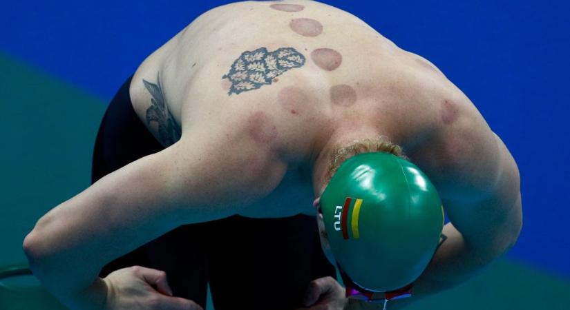 Mik ezek a furcsa foltok a sportolókon az olimpián?