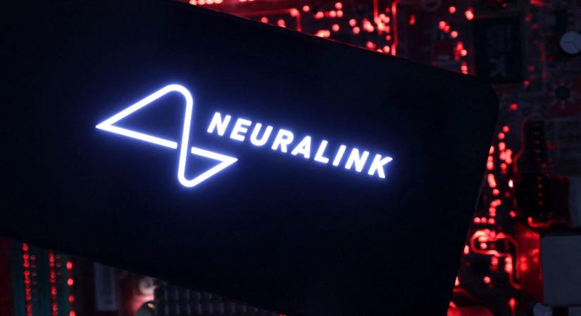 Musk szerint újabb ember kapott Neuralink agyi chipet