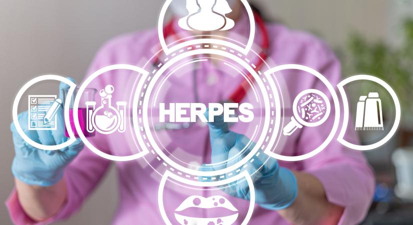 Tévhitek a nemi herpeszről - ezeket tudják a legtöbben rosszul az állapottal kapcsolatban