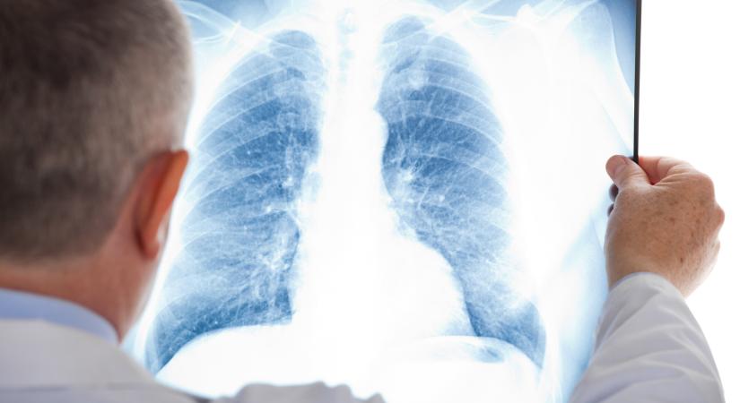 A tüdőembólia tünetei és okai
