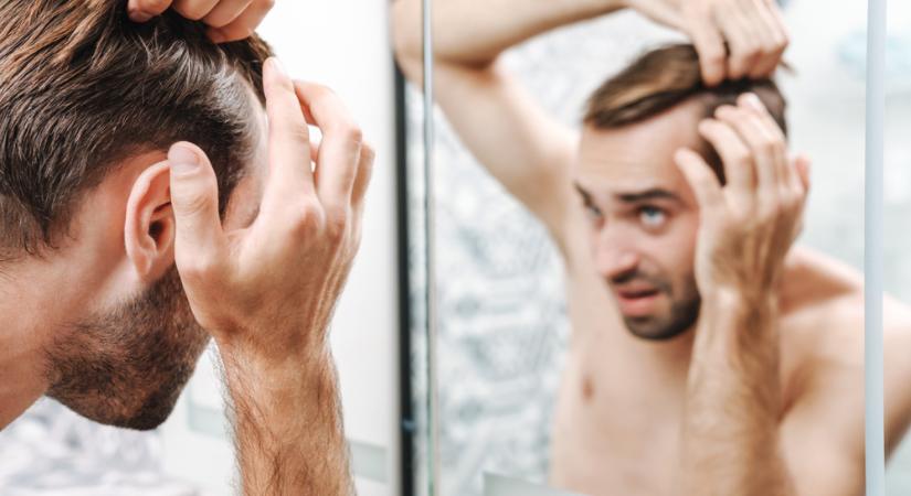 A hajhullás okai, a hajnövesztő szerek és kiegészítők pozitív hatásai