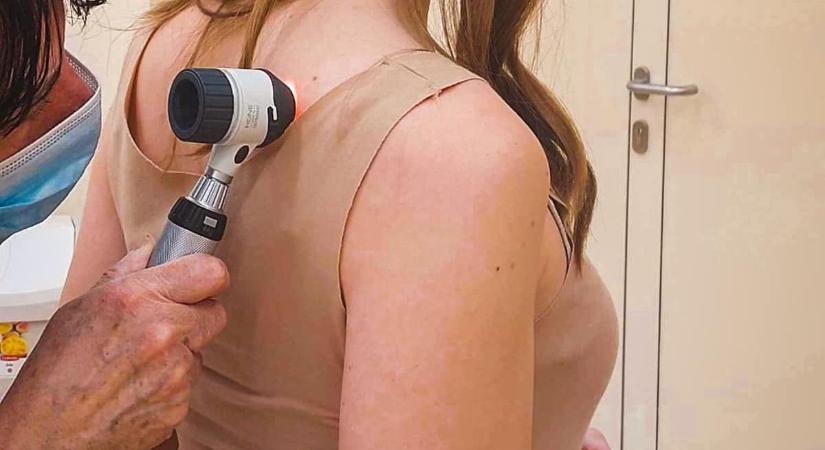 Ingyenes melanomaszűrés lesz egy debreceni fürdőben