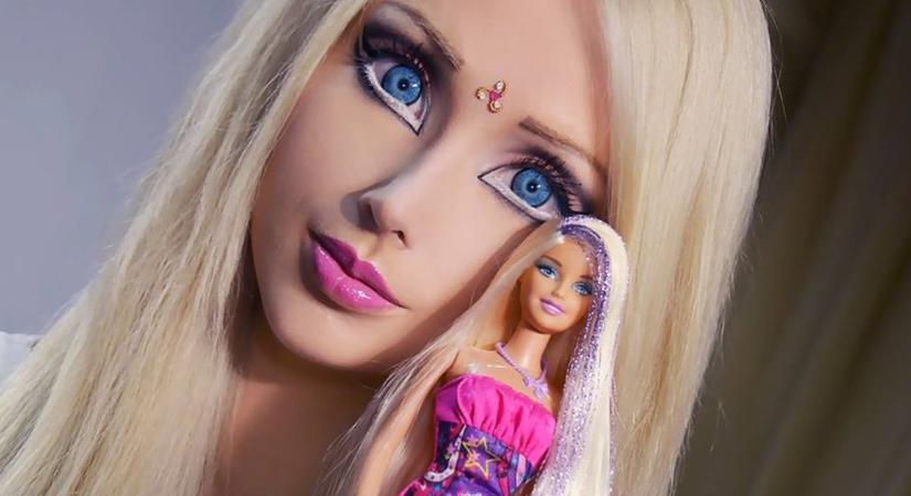 Végképp eltorzult a teste! Borzasztóvá műtette magát az emberi Barbie (Fotók!)