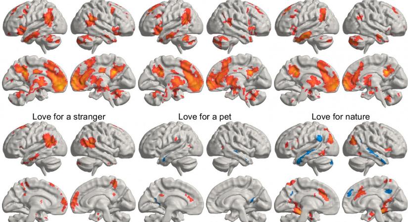 Megvan, hogy hol „laknak” az agyban a különféle szeretetek