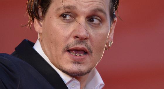 Johnny Depp végre meggyógyíttatta „rohadó” fogsorát