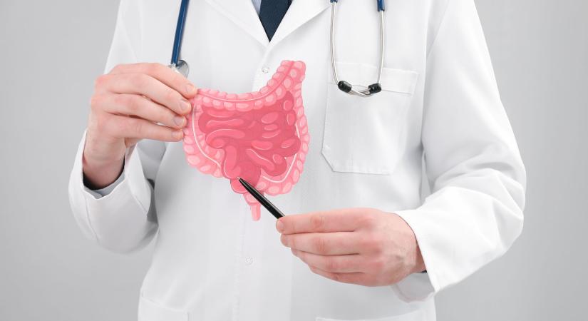 Így jelzi előre bélflóránk a Crohn-betegség kiújulását