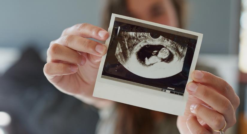 Emiatt csuklanak a babák az anyukájuk hasában