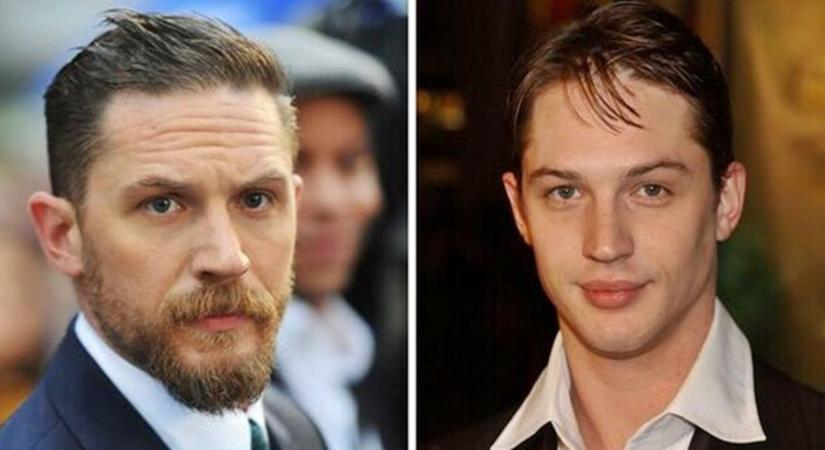 Sokkoló dolgok derültek ki Tom Hardy múltjáról: „Óriási mázli, hogy nem kaptam el hepatitist vagy AIDS-et”