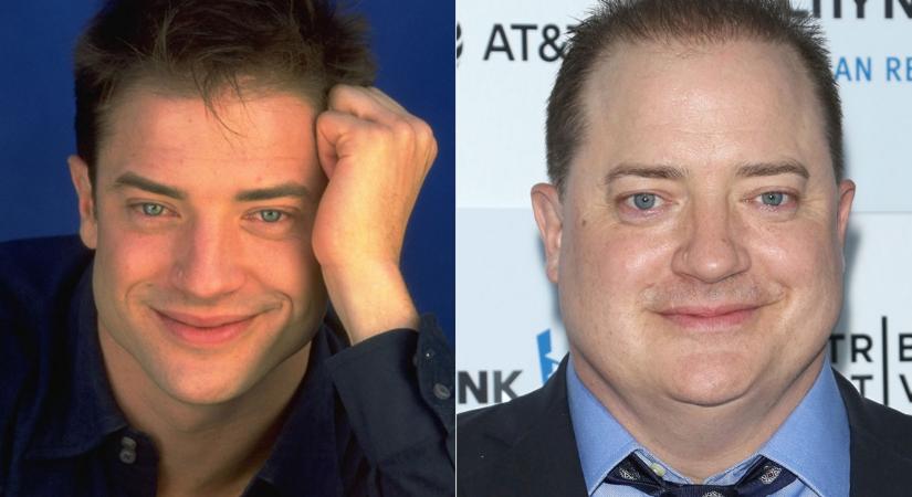 Ez volt Brendan Fraser hosszú éveken át tartó eltűnésének az oka