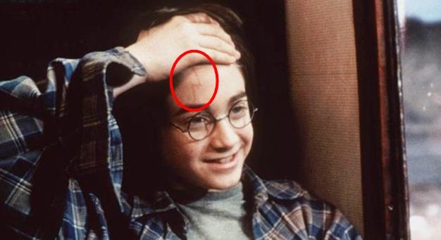 Harry Potter sebhelyének titka teljesen más, mint amit ezidáig hittünk!