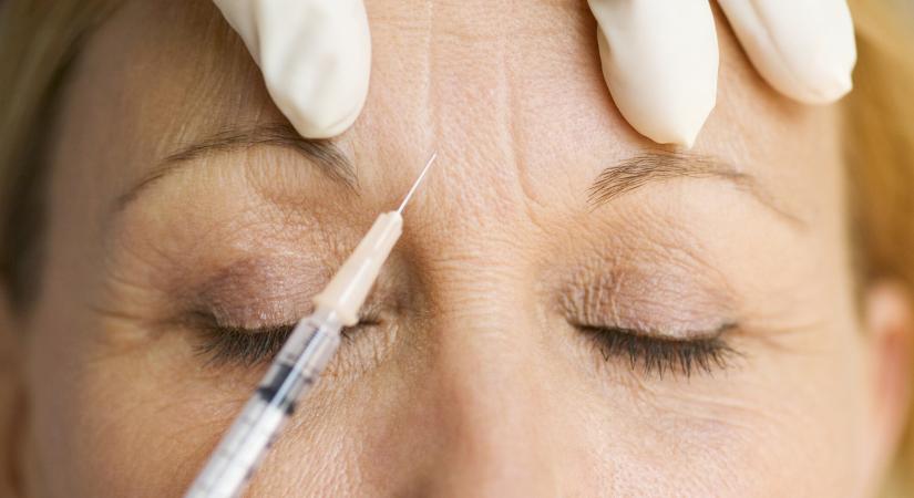 Botox: ezeket a panaszokat enyhíti az erős méreg