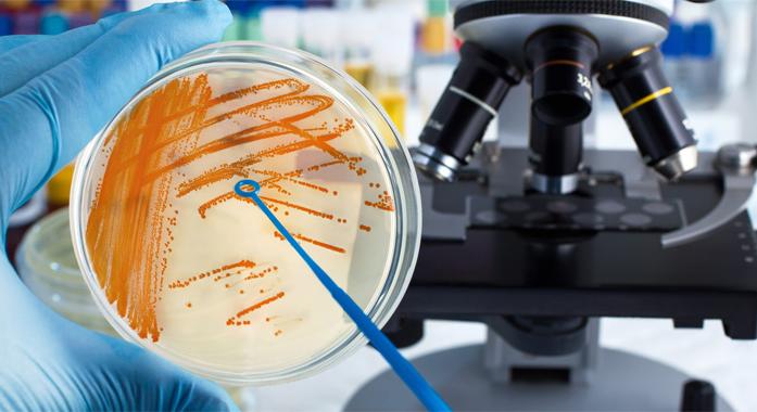 Streptococcus pyogenes, a húsevő baktérium