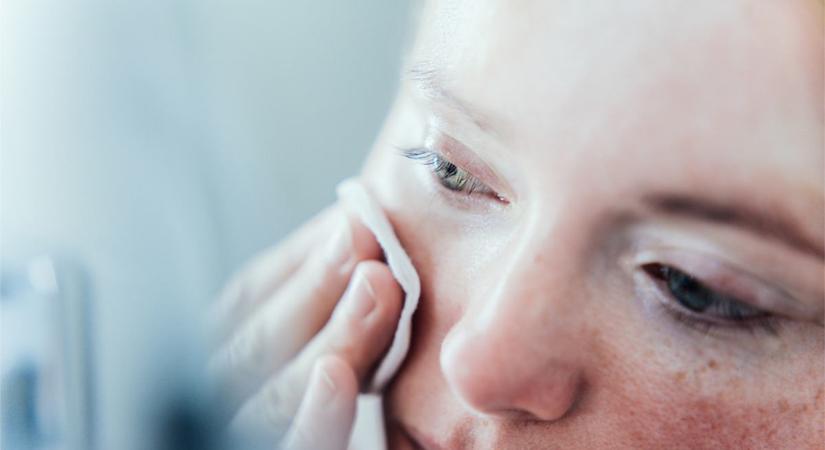 Ekcémára diólevél, aknéra galajtea: 8 bőrgyógyító gyógynövény