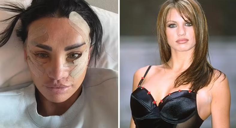 Felismerhetetlen lett a sok arcplasztikától Katie Price