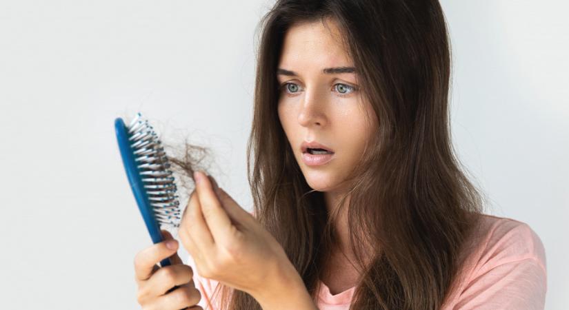 Mitől számít kórosnak a hajhullás? - Ha ezt tapasztalod, fordulj orvoshoz