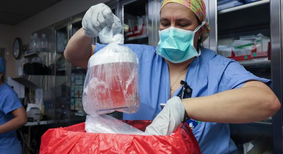 Kiderült, mibe halt bele az első ember, akibe sertésvesét ültettek