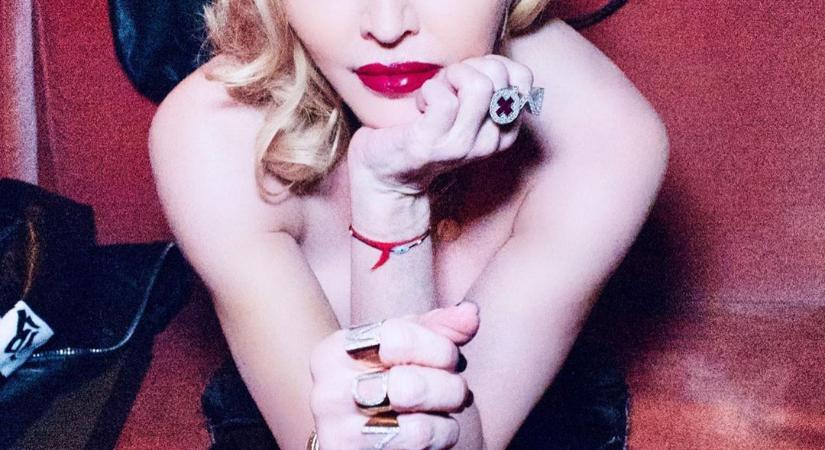 Így néz ki Madonna teste köpölyözés után - Fotó