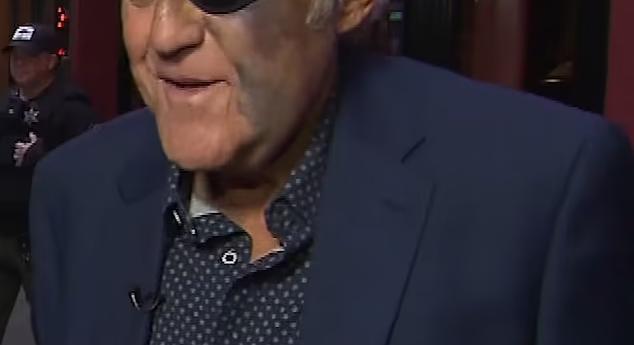 Sokkoló baleset! Félszemű lett a legendás Jay Leno - fotó