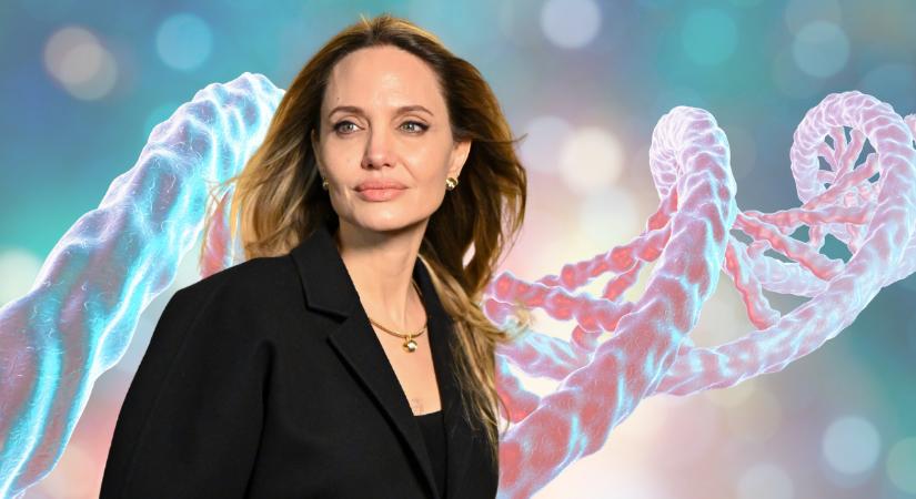 Angelina Jolie egy DNS-vizsgálat miatt vetette le a melleit, de a szakember szerint ne rohanjunk egyből teszteltetni