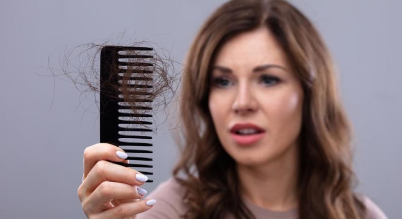 Vess véget a hajhullásnak: Ezzel az 5 módszerrel búcsút inthetsz a kopasz foltoknak