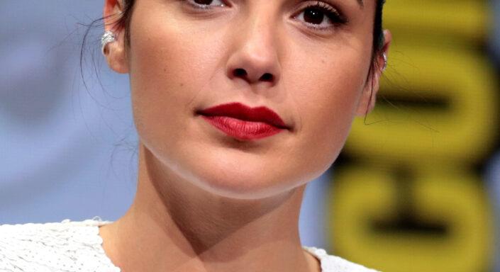 Gal Gadot izraeli sztárszínész agyából vérrögöt távolítottak el