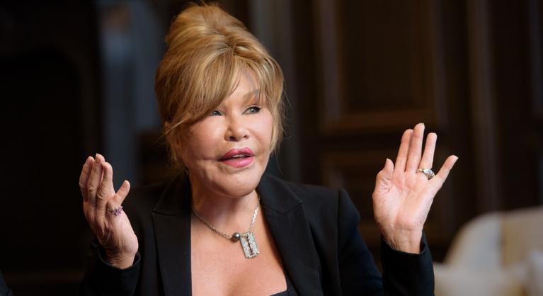 Meghalt az extrém plasztikai műtéti függőségéről ismert Jocelyn Wildenstein, a „Macskanő”