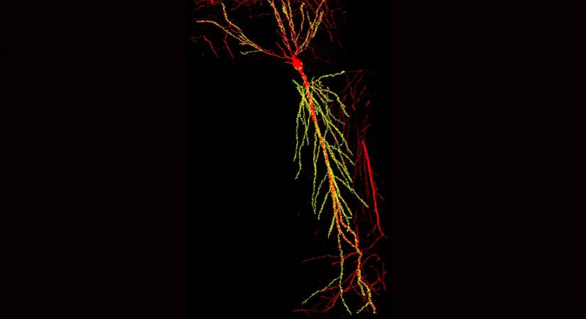A memóriazavarok kezeléséhez viheti közelebb a tudományt magyar és amerikai kutatók felfedezése